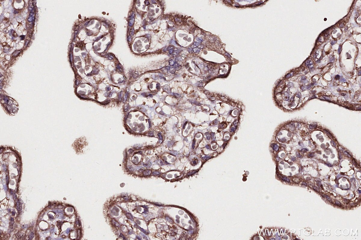 Immunohistochemical analysis of paraffin-embedded human placenta tissue slide using KHC2707 (SHKBP1 IHC Kit).
