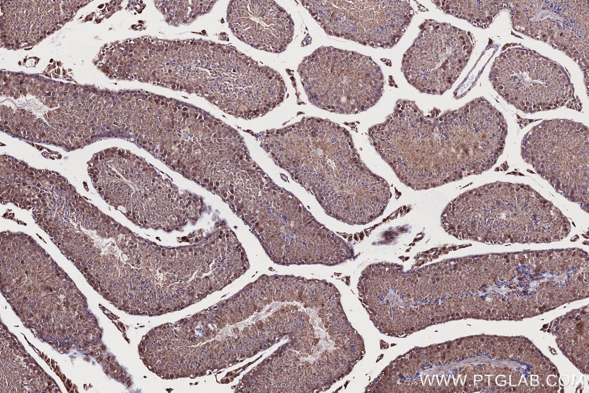 Immunohistochemical analysis of paraffin-embedded mouse testis tissue slide using KHC2707 (SHKBP1 IHC Kit).