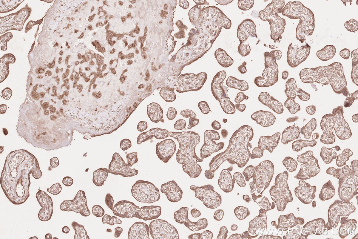 Immunohistochemical analysis of paraffin-embedded human placenta tissue slide using KHC2604 (SHLD3 IHC Kit).