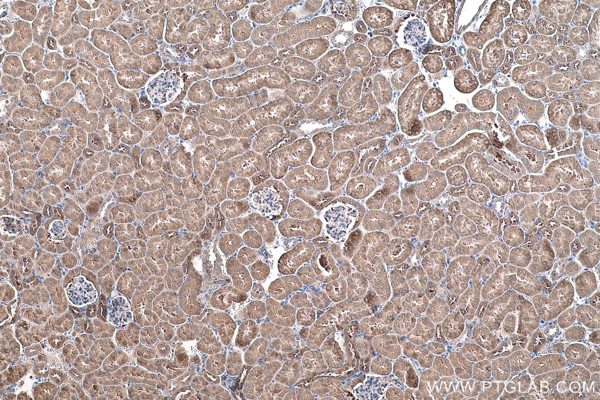 Immunohistochemical analysis of paraffin-embedded mouse kidney tissue slide using KHC0566 (SHMT1 IHC Kit).