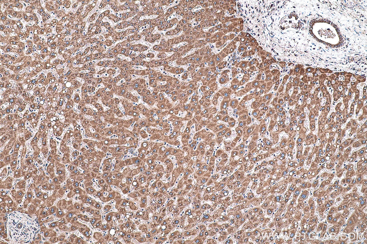 Immunohistochemical analysis of paraffin-embedded human liver tissue slide using KHC0566 (SHMT1 IHC Kit).