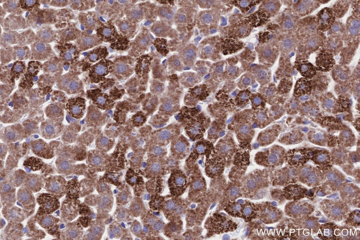 Immunohistochemical analysis of paraffin-embedded mouse liver tissue slide using KHC2643 (SIAH1 IHC Kit).