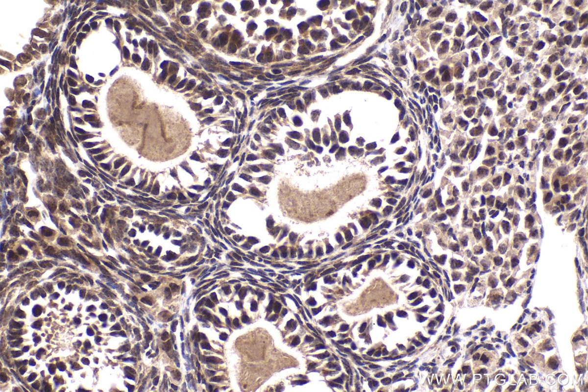 Immunohistochemical analysis of paraffin-embedded mouse ovary tissue slide using KHC2076 (SIAH2 IHC Kit).