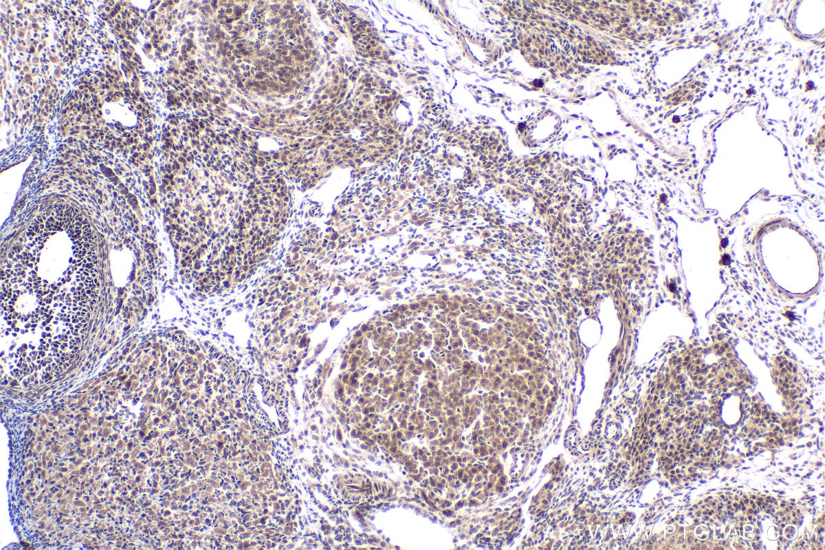 Immunohistochemical analysis of paraffin-embedded rat ovary tissue slide using KHC2076 (SIAH2 IHC Kit).