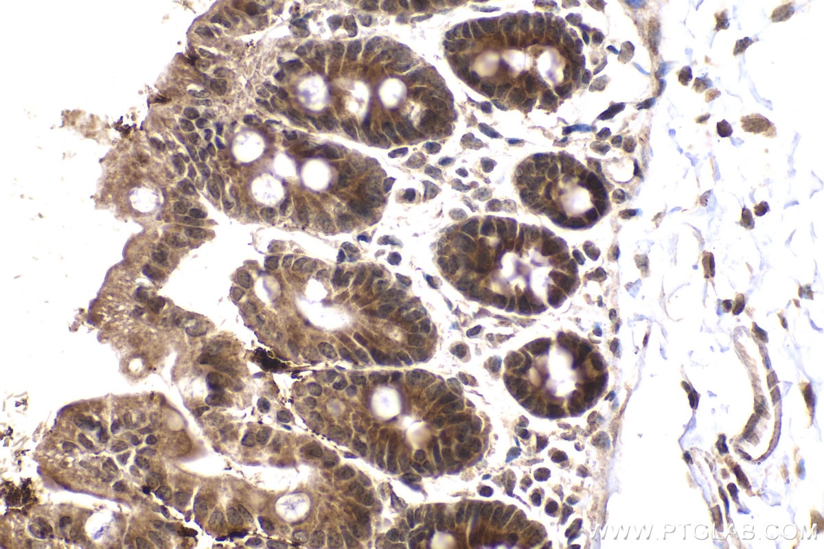 Immunohistochemical analysis of paraffin-embedded mouse small intestine tissue slide using KHC2076 (SIAH2 IHC Kit).