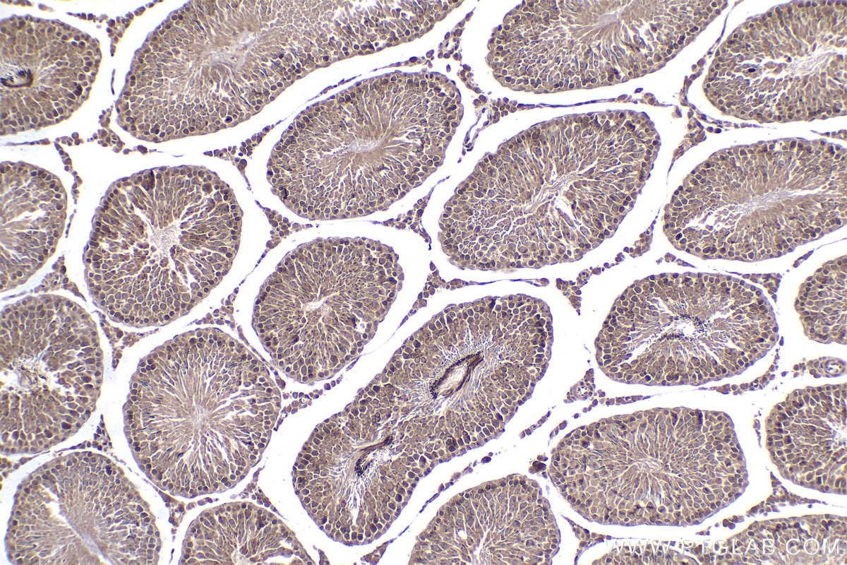 Immunohistochemical analysis of paraffin-embedded rat testis tissue slide using KHC2076 (SIAH2 IHC Kit).