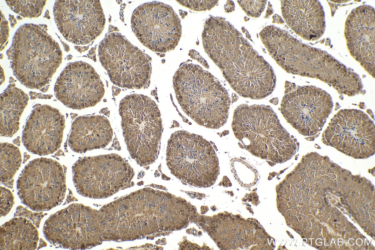 Immunohistochemical analysis of paraffin-embedded mouse testis tissue slide using KHC2060 (SIP1 IHC Kit).