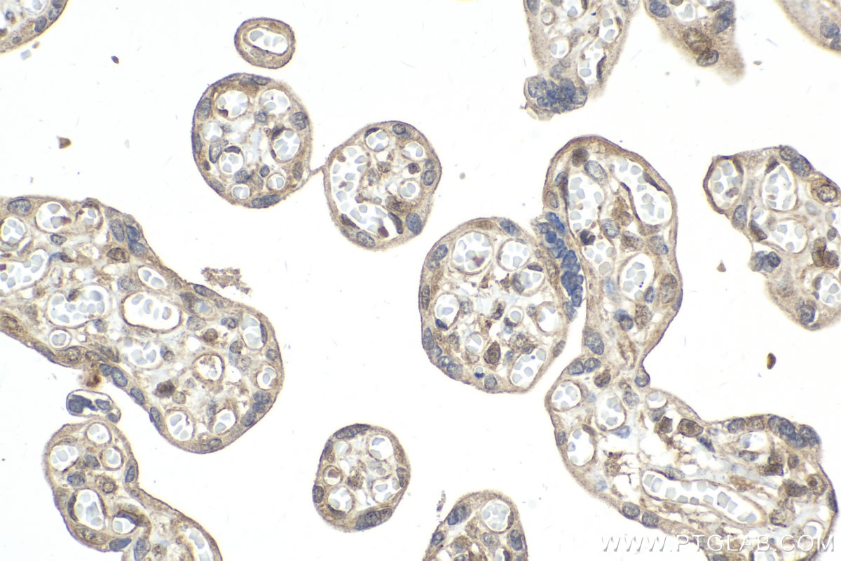 Immunohistochemical analysis of paraffin-embedded human placenta tissue slide using KHC2060 (SIP1 IHC Kit).