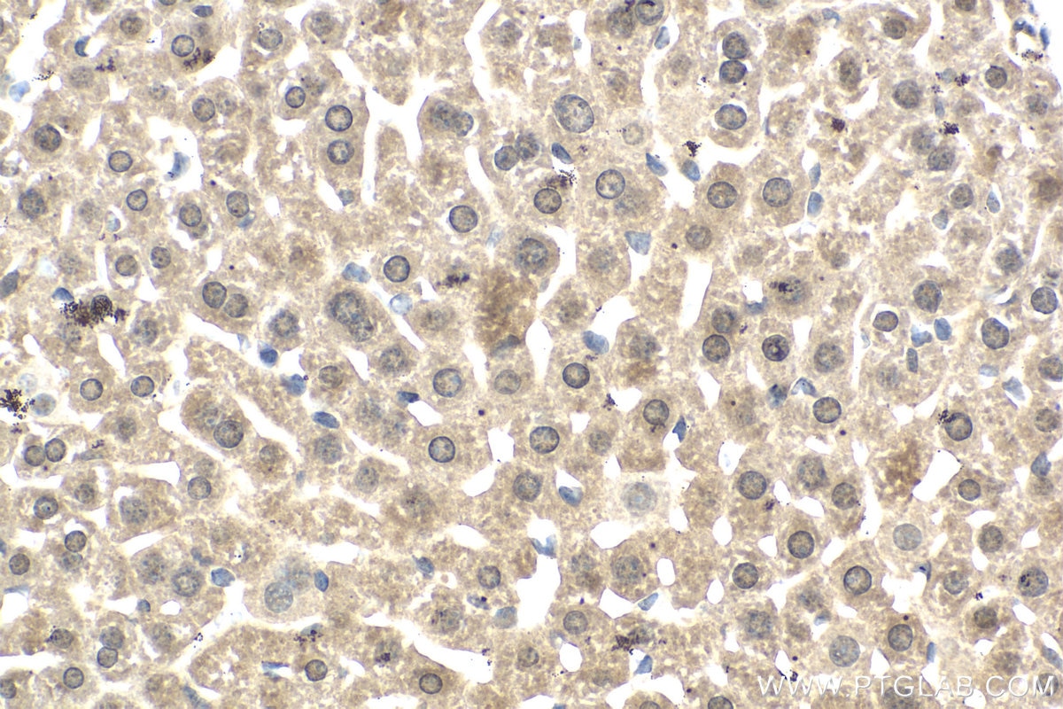 Immunohistochemical analysis of paraffin-embedded mouse liver tissue slide using KHC2060 (SIP1 IHC Kit).