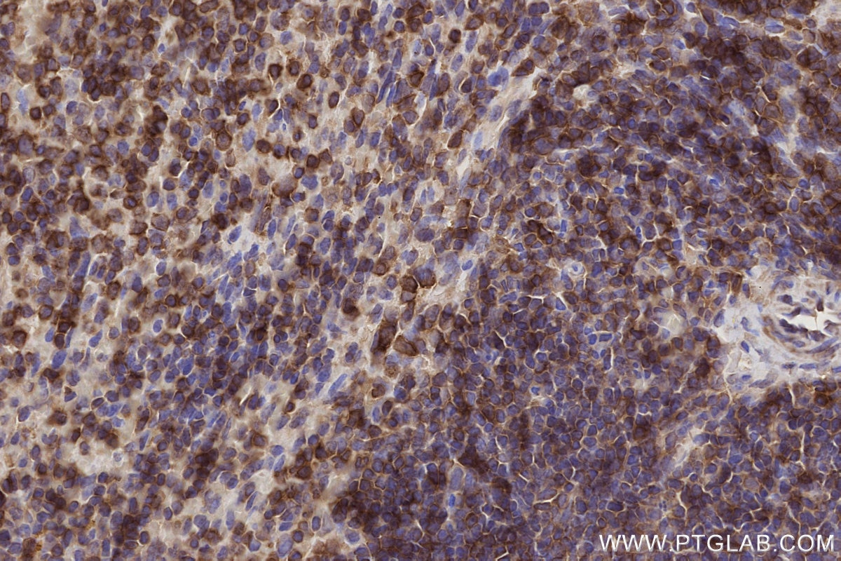 Immunohistochemical analysis of paraffin-embedded mouse spleen tissue slide using KHC2792 (SIPA1 IHC Kit).