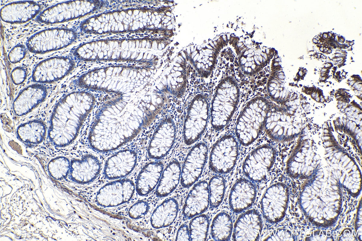 Immunohistochemical analysis of paraffin-embedded human colon tissue slide using KHC1207 (SIRT1 IHC Kit).