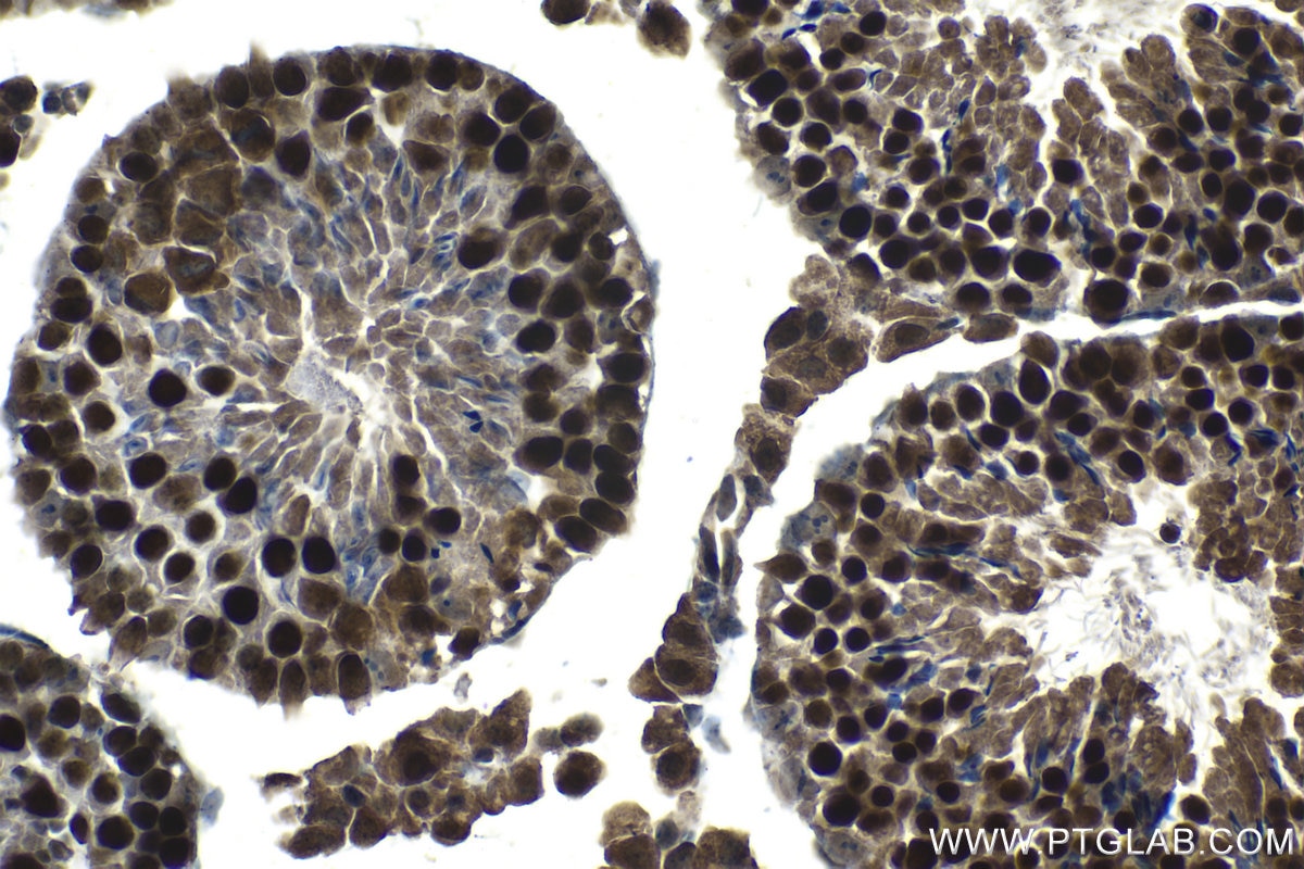 Immunohistochemical analysis of paraffin-embedded mouse testis tissue slide using KHC1207 (SIRT1 IHC Kit).