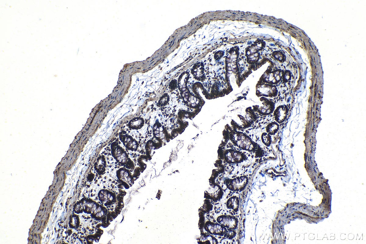 Immunohistochemical analysis of paraffin-embedded rat colon tissue slide using KHC1207 (SIRT1 IHC Kit).