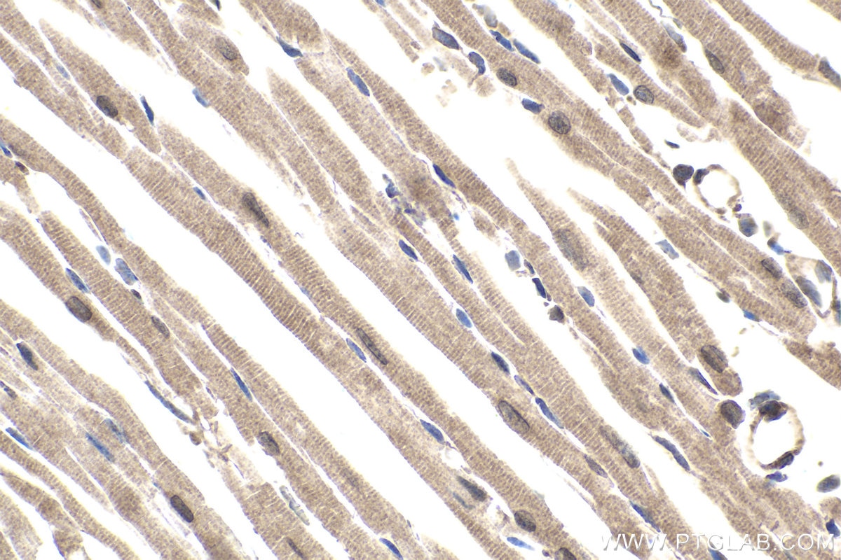 Immunohistochemical analysis of paraffin-embedded mouse heart tissue slide using KHC1821 (SIRT2 IHC Kit).