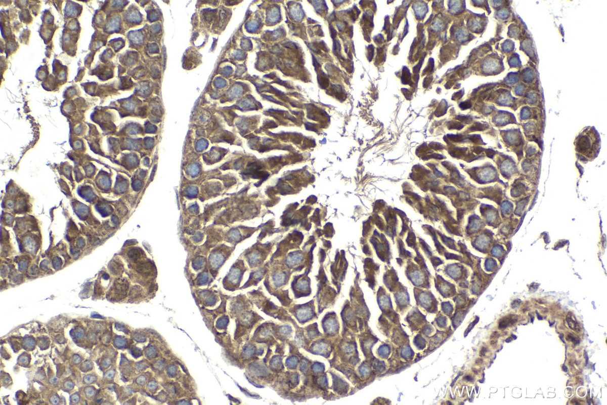 Immunohistochemical analysis of paraffin-embedded mouse testis tissue slide using KHC1821 (SIRT2 IHC Kit).