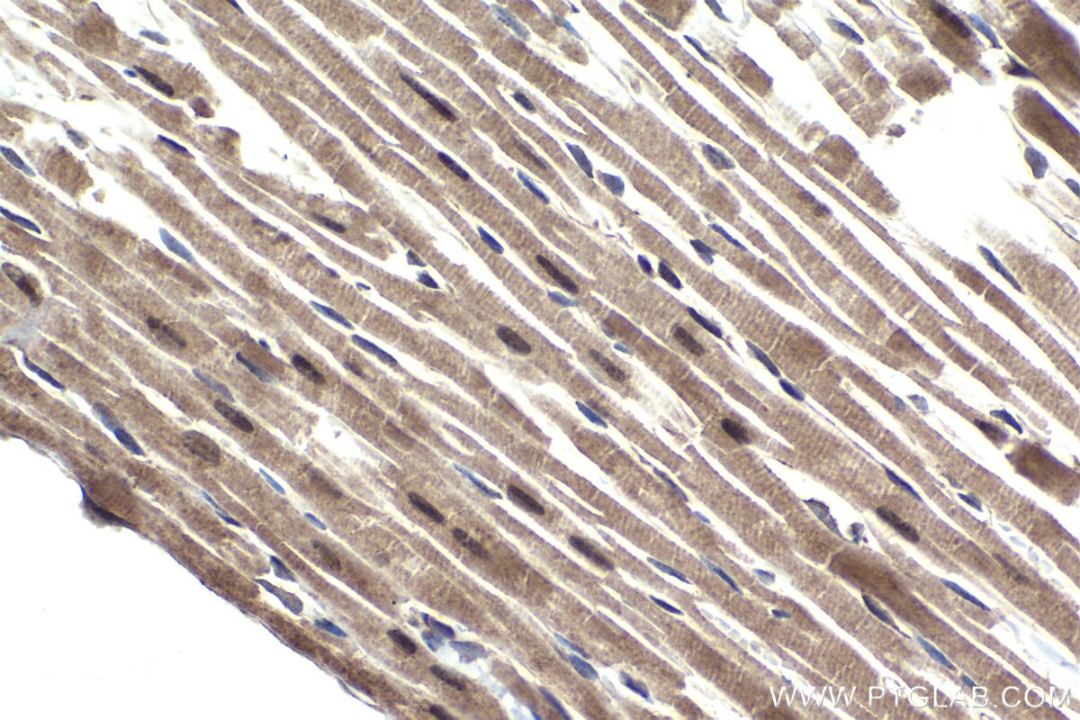 Immunohistochemical analysis of paraffin-embedded rat heart tissue slide using KHC1821 (SIRT2 IHC Kit).