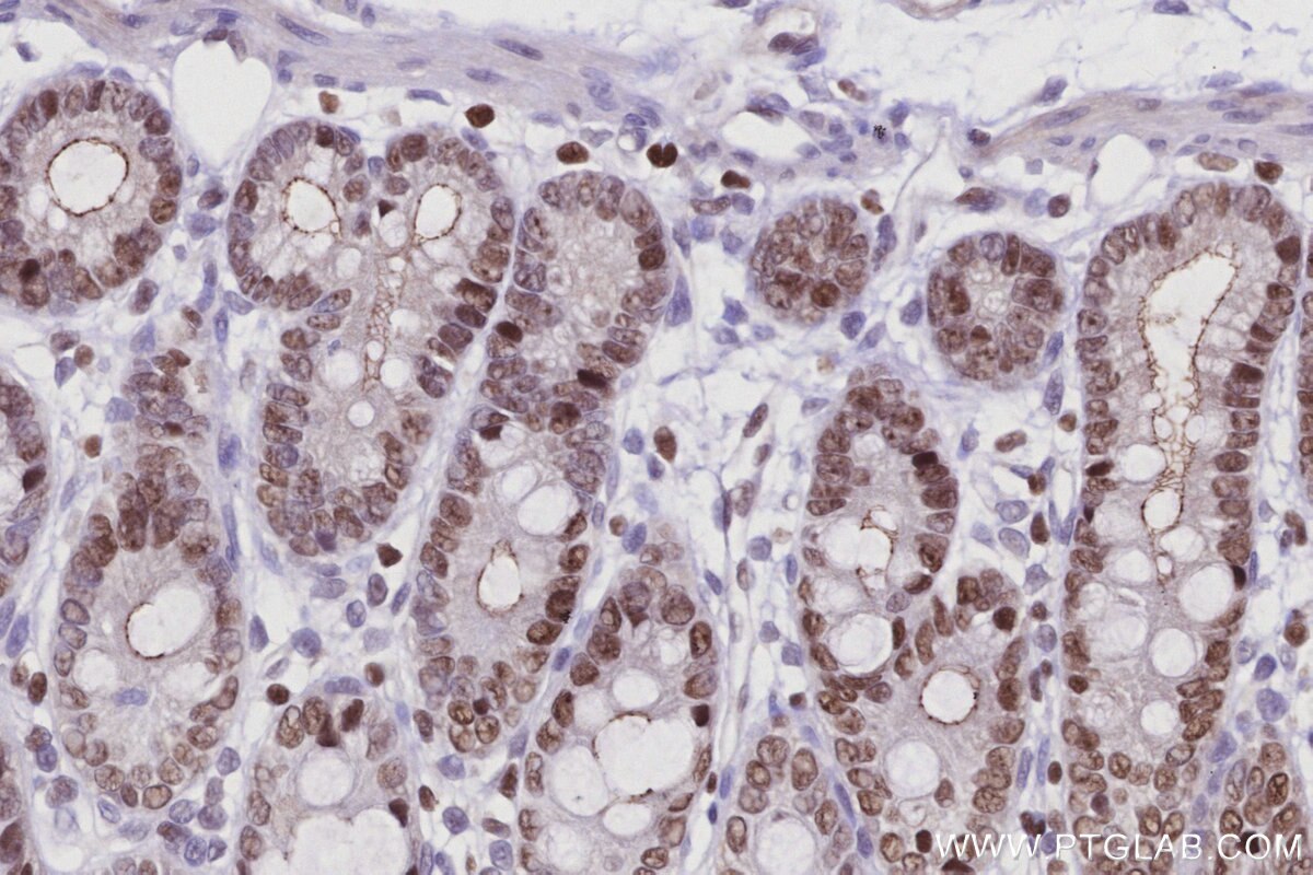 Immunohistochemical analysis of paraffin-embedded rat colon tissue slide using KHC2950 (SIRT7 IHC Kit).