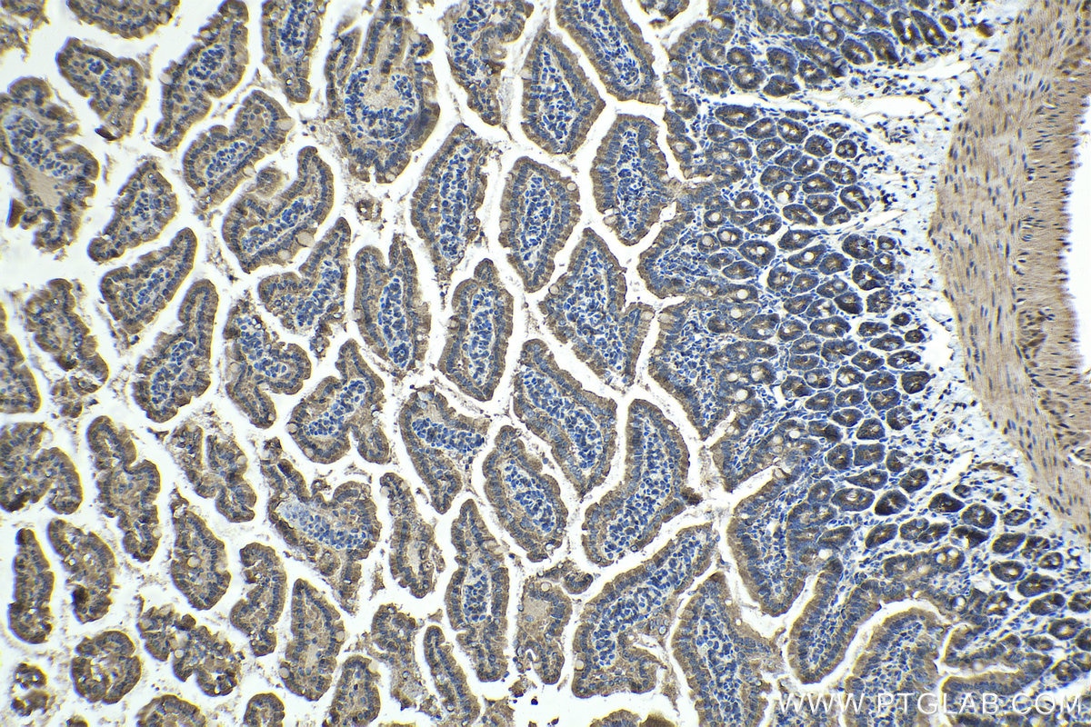 Immunohistochemical analysis of paraffin-embedded mouse small intestine tissue slide using KHC1443 (SIVA1 IHC Kit).