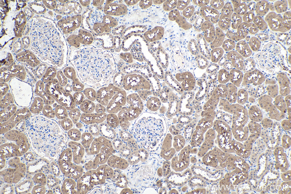 Immunohistochemical analysis of paraffin-embedded human kidney tissue slide using KHC0269 (SIX1 IHC Kit).