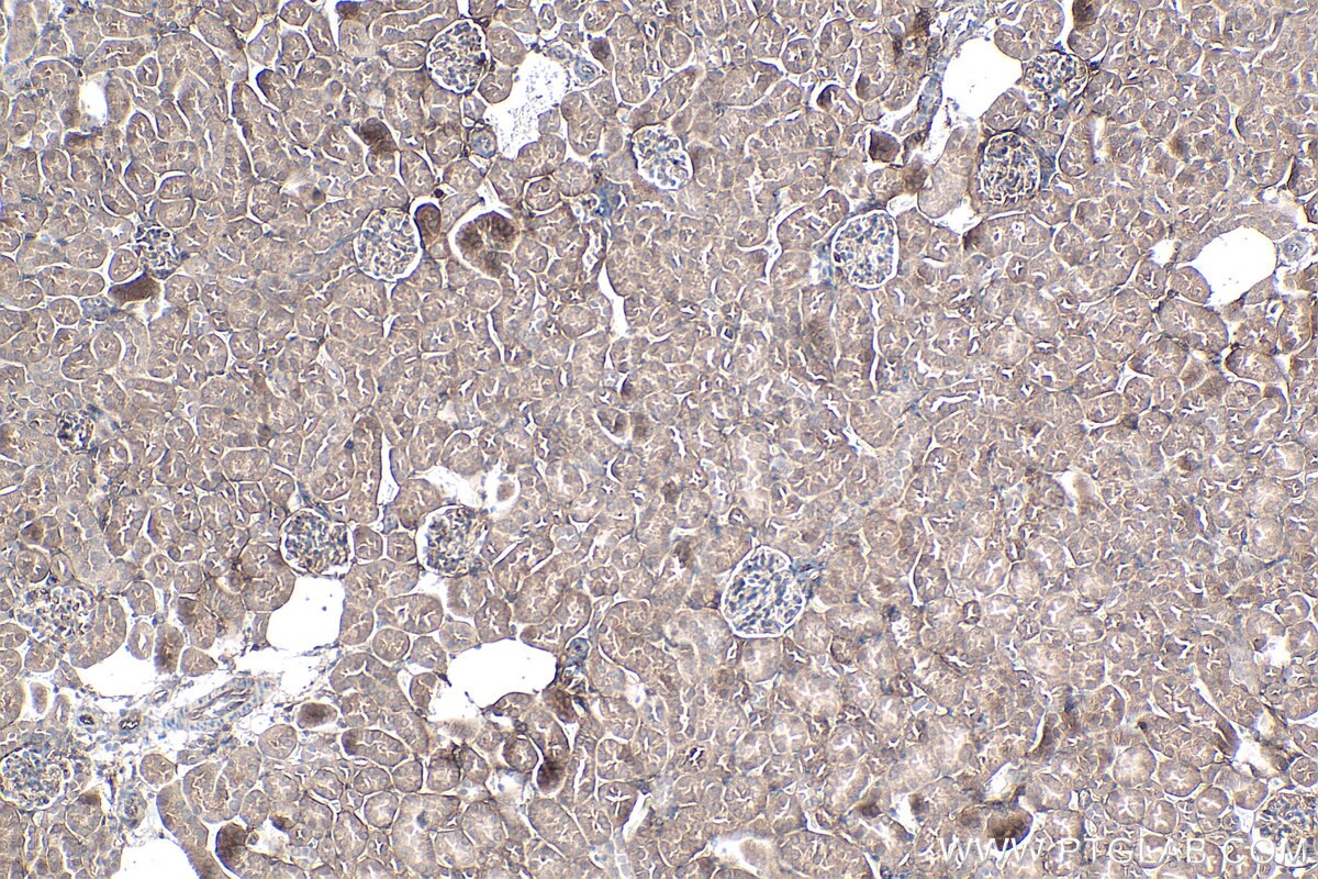 Immunohistochemical analysis of paraffin-embedded mouse kidney tissue slide using KHC0269 (SIX1 IHC Kit).