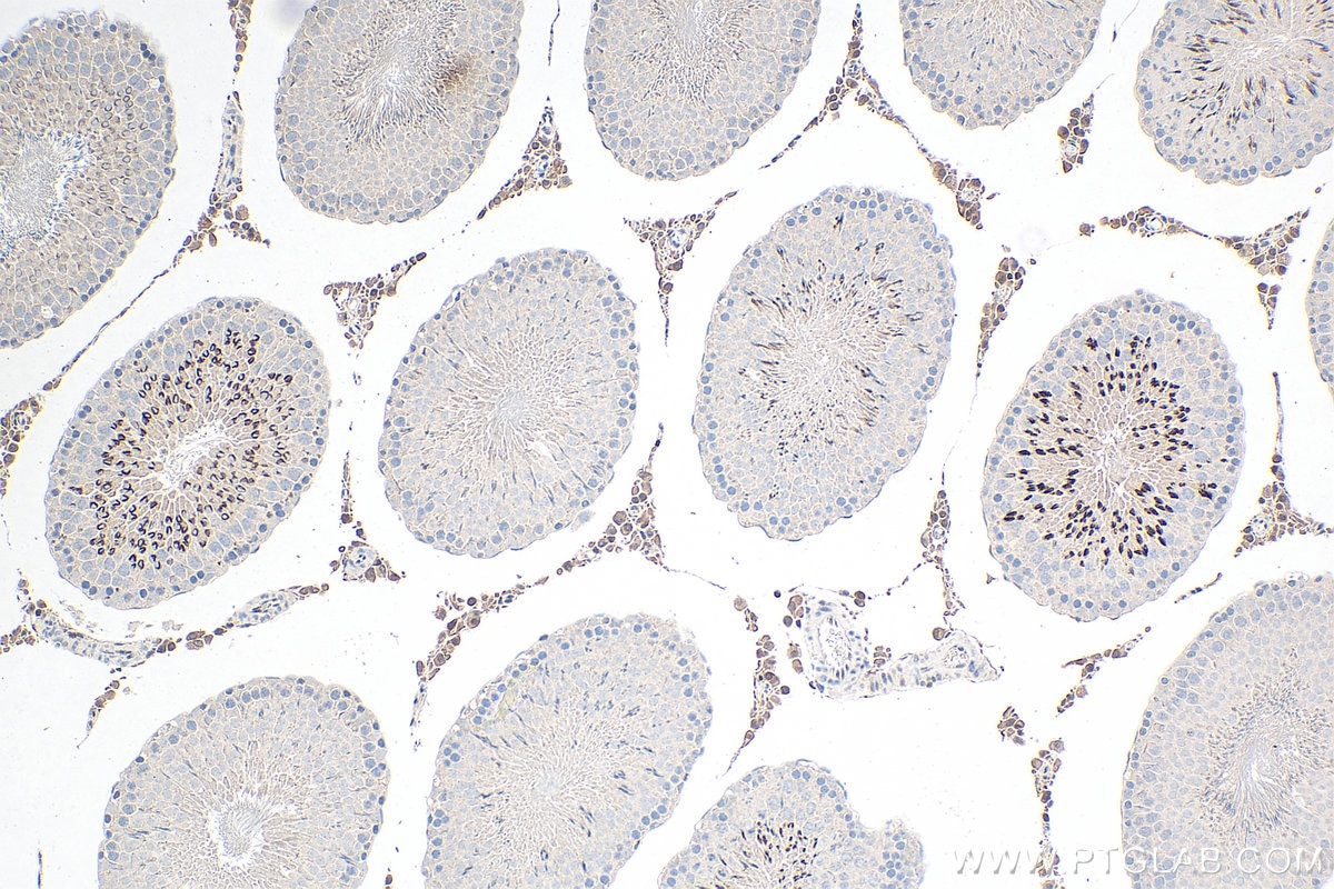 Immunohistochemical analysis of paraffin-embedded rat testis tissue slide using KHC0269 (SIX1 IHC Kit).