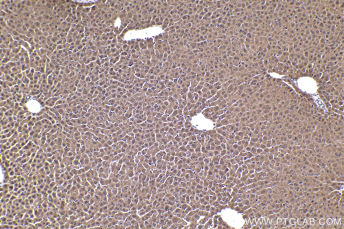 Immunohistochemical analysis of paraffin-embedded mouse liver tissue slide using KHC1830 (SIX5 IHC Kit).