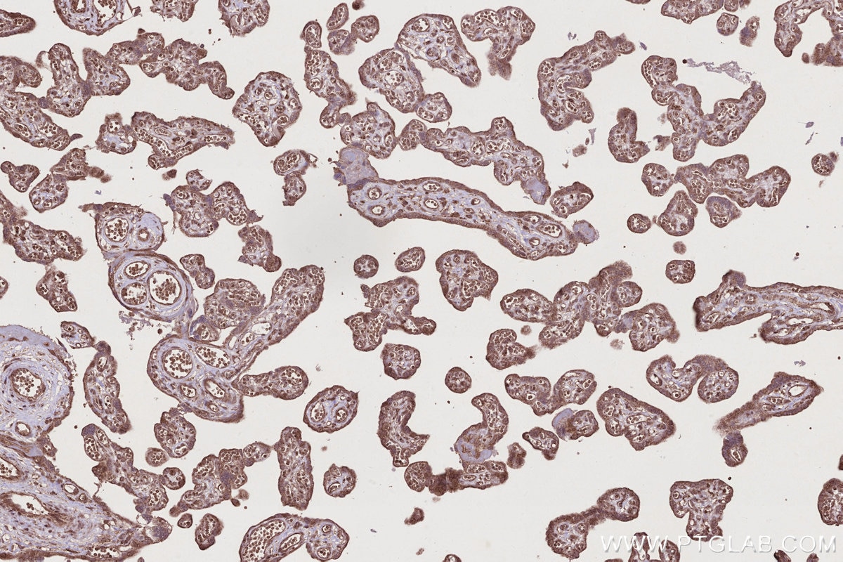 Immunohistochemical analysis of paraffin-embedded human placenta tissue slide using KHC2778 (SKA1/C18orf24 IHC Kit). Immunohistochemical analysis of paraffin-embedded human placenta tissue slide using KHC2778 (SKA1/C18orf24 IHC Kit).