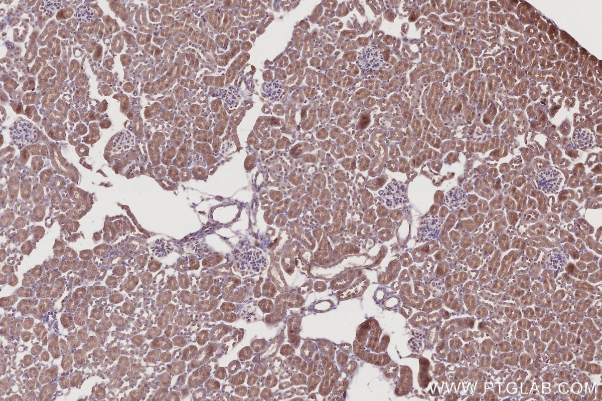 Immunohistochemical analysis of paraffin-embedded mouse kidney tissue slide using KHC2778 (SKA1/C18orf24 IHC Kit). Immunohistochemical analysis of paraffin-embedded mouse kidney tissue slide using KHC2778 (SKA1/C18orf24 IHC Kit).