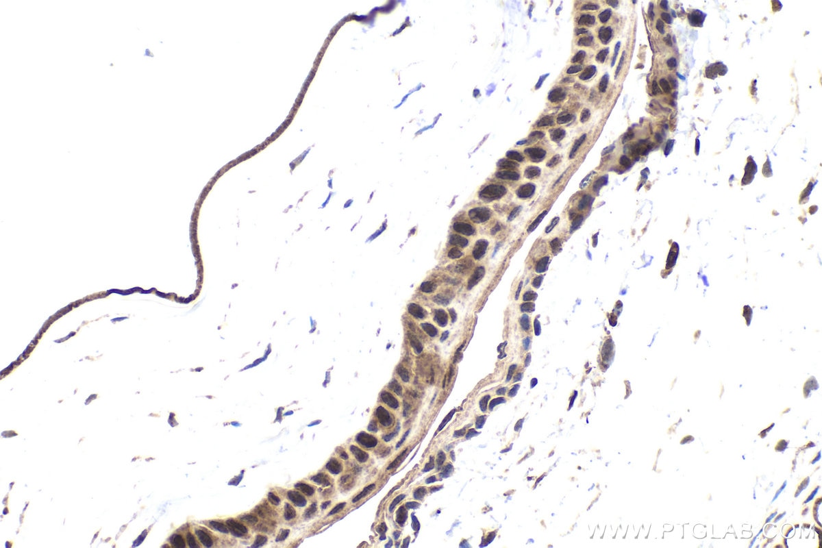 Immunohistochemical analysis of paraffin-embedded mouse eye tissue slide using KHC1768 (SKOR2 IHC Kit).