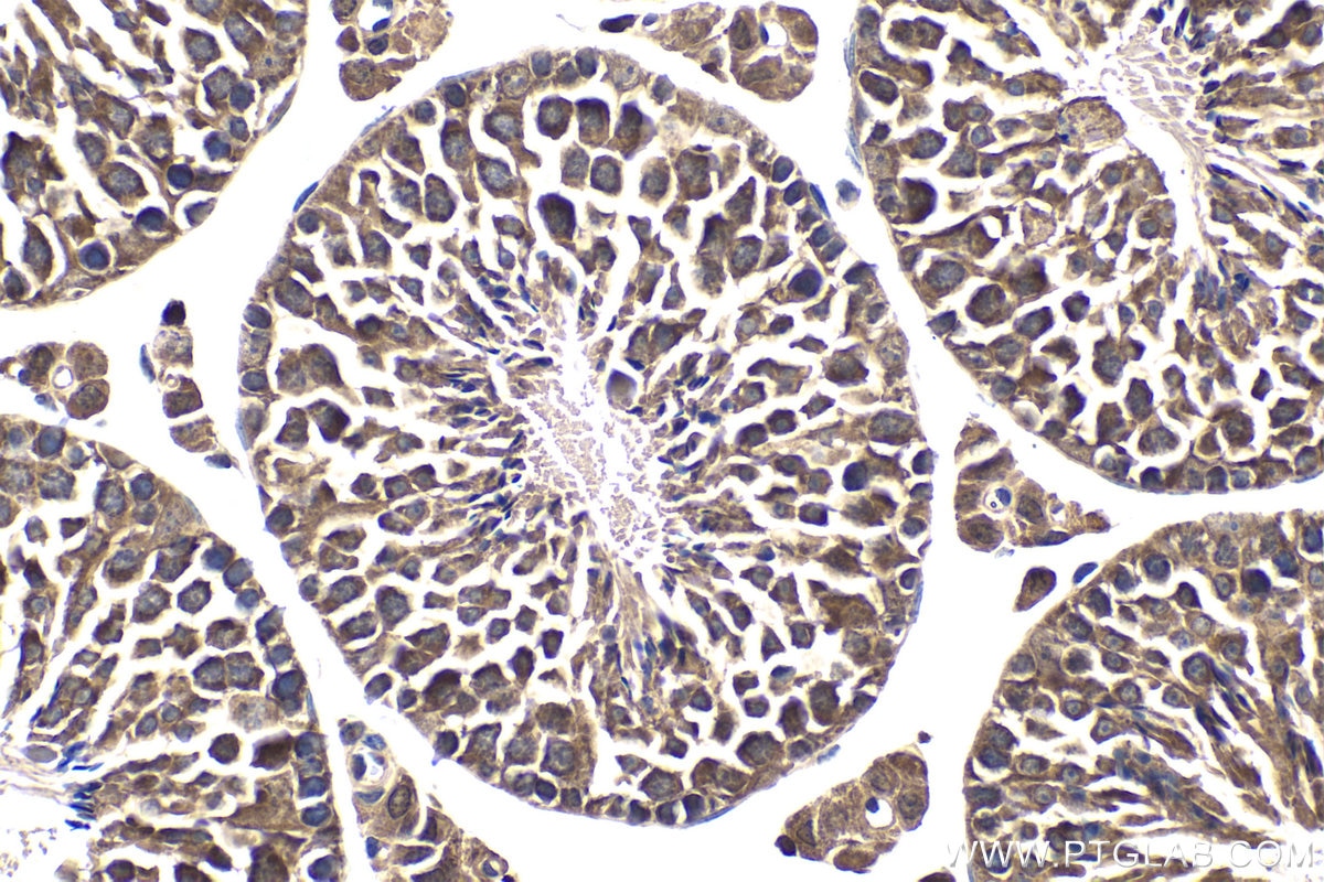 Immunohistochemical analysis of paraffin-embedded mouse testis tissue slide using KHC1768 (SKOR2 IHC Kit).