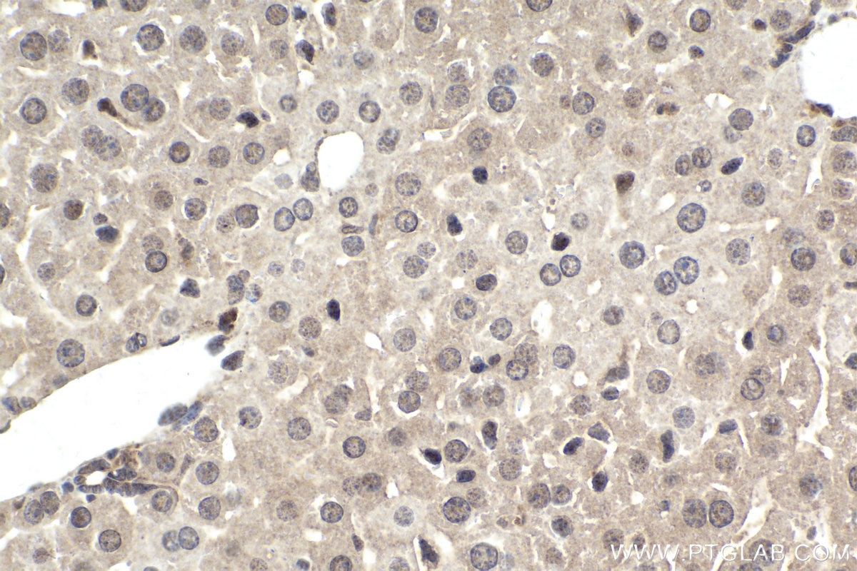 Immunohistochemical analysis of paraffin-embedded mouse liver tissue slide using KHC1709 (SKP2 IHC Kit).