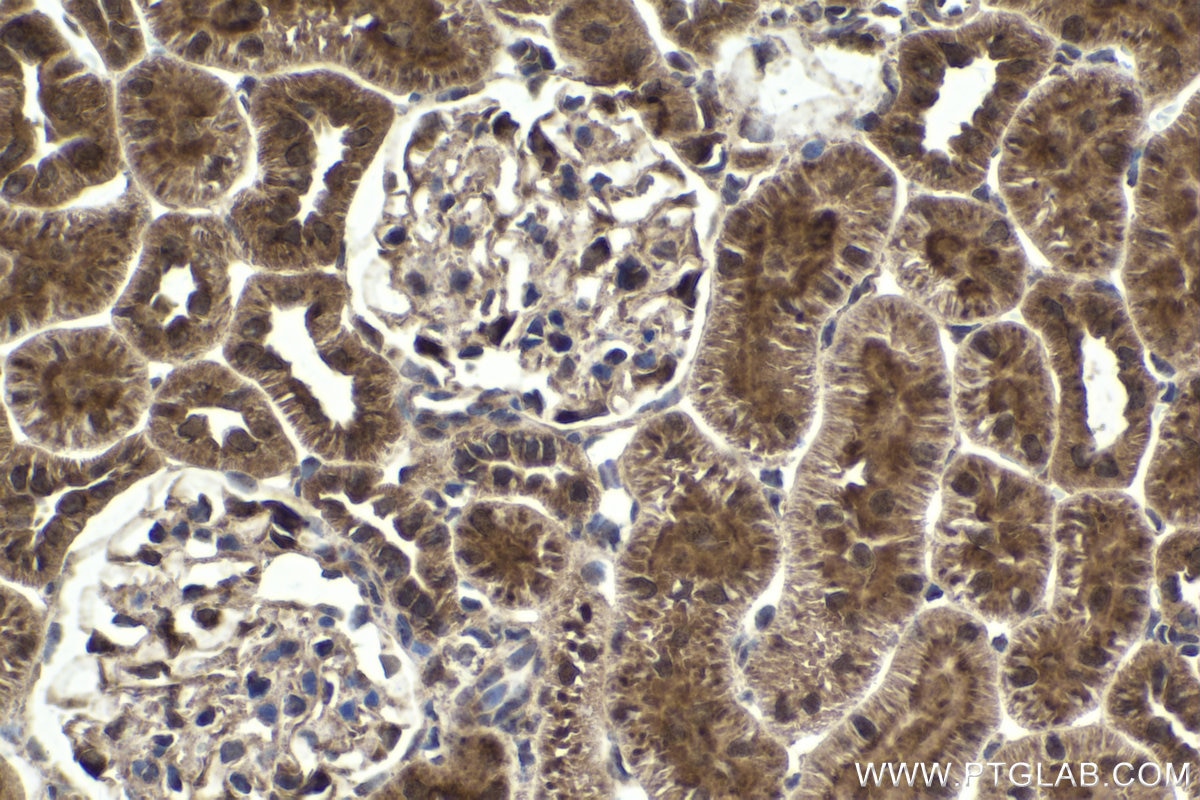 Immunohistochemical analysis of paraffin-embedded rat kidney tissue slide using KHC1709 (SKP2 IHC Kit).