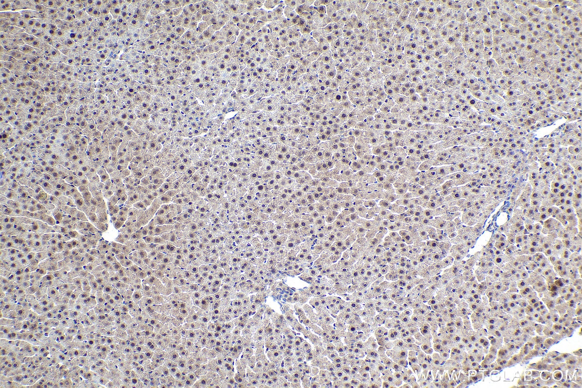 Immunohistochemical analysis of paraffin-embedded rat liver tissue slide using KHC1709 (SKP2 IHC Kit).