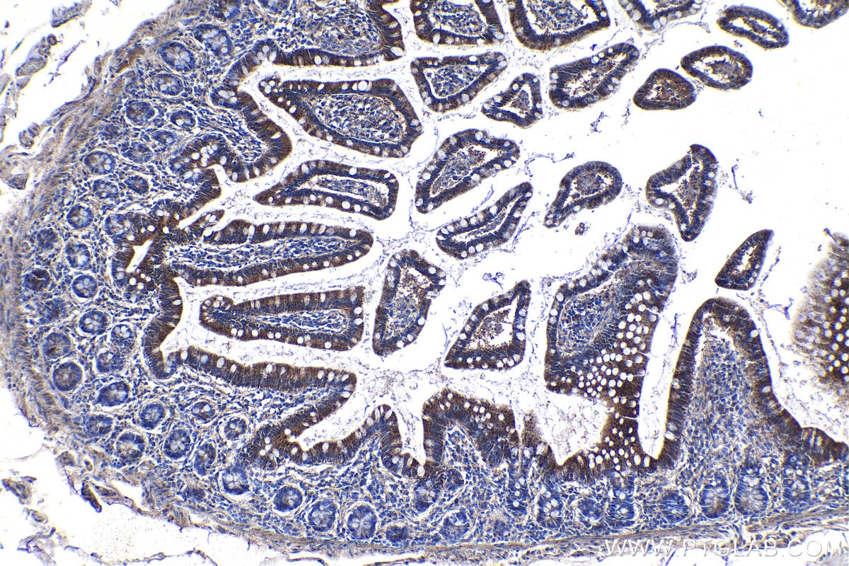 Immunohistochemical analysis of paraffin-embedded human small intestine tissue slide using KHC1147 (SLC11A1 IHC Kit).