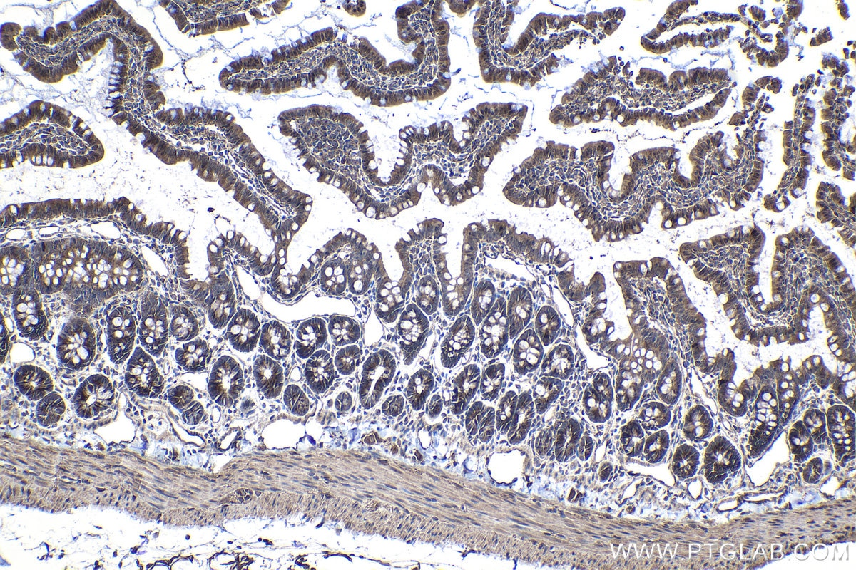 Immunohistochemical analysis of paraffin-embedded rat small intestine tissue slide using KHC1147 (SLC11A1 IHC Kit).