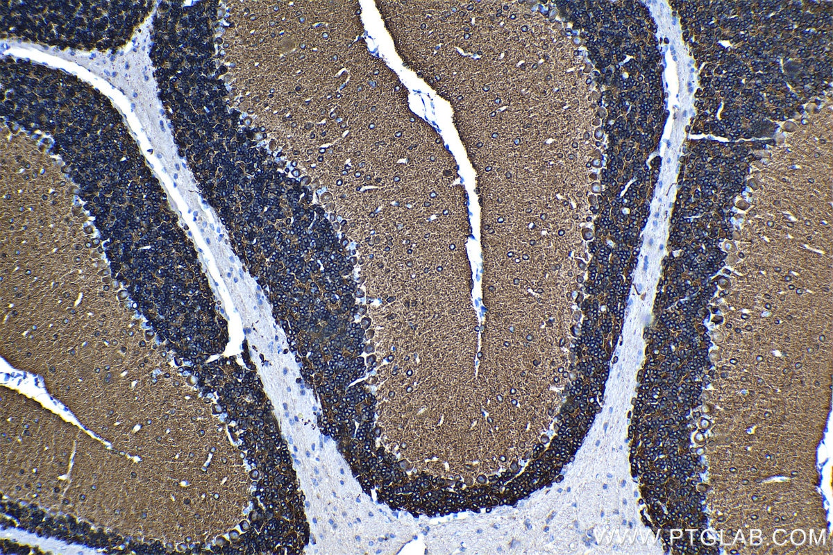 Immunohistochemical analysis of paraffin-embedded mouse cerebellum tissue slide using KHC1344 (SLC12A5 IHC Kit).