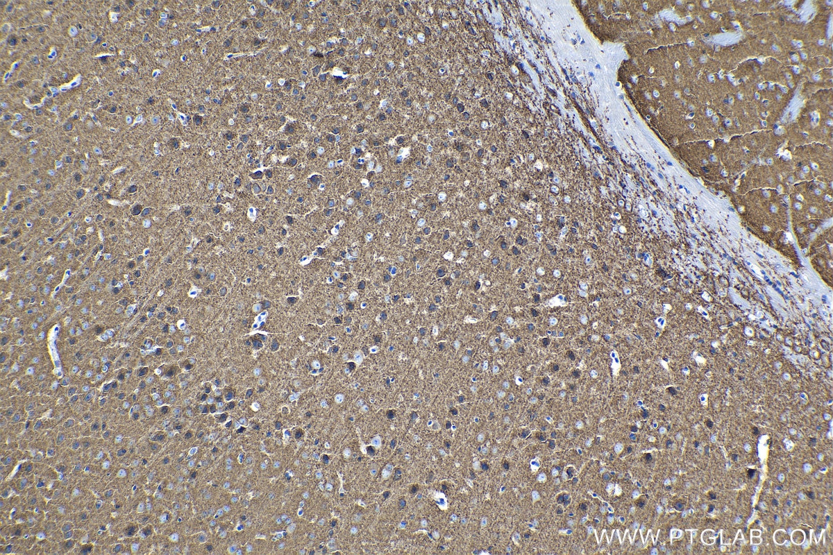 Immunohistochemical analysis of paraffin-embedded mouse brain tissue slide using KHC1344 (SLC12A5 IHC Kit).