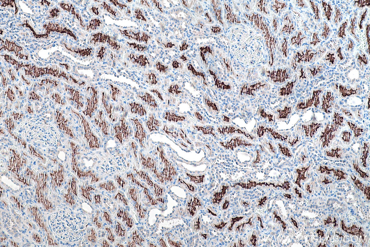 Immunohistochemical analysis of paraffin-embedded human kidney tissue slide using KHC0194 (SLC13A2 IHC Kit).