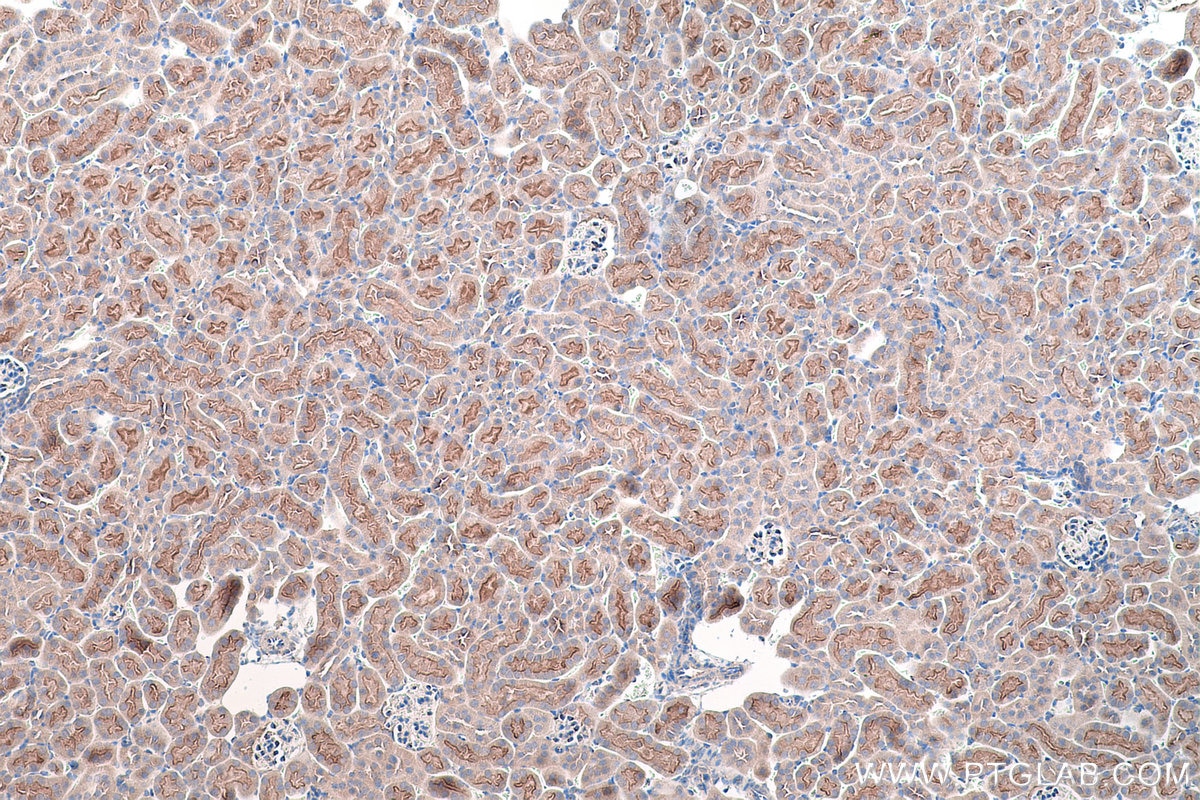Immunohistochemical analysis of paraffin-embedded mouse kidney tissue slide using KHC0194 (SLC13A2 IHC Kit).