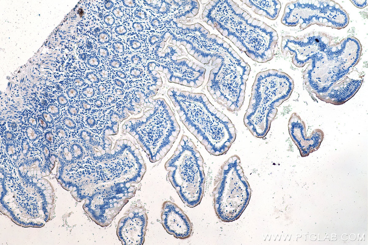 Immunohistochemical analysis of paraffin-embedded human small intestine tissue slide using KHC0194 (SLC13A2 IHC Kit).
