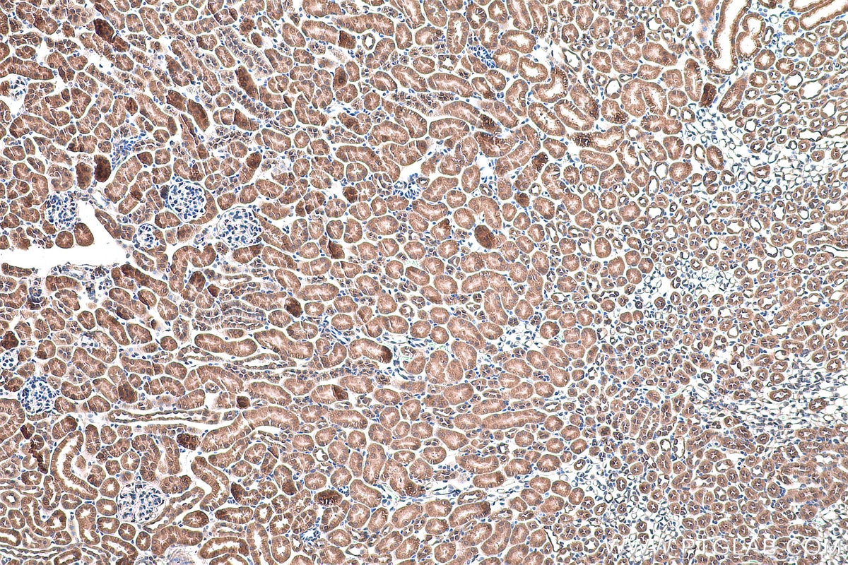 Immunohistochemical analysis of paraffin-embedded mouse kidney tissue slide using KHC0809 (SLC16A12 IHC Kit).