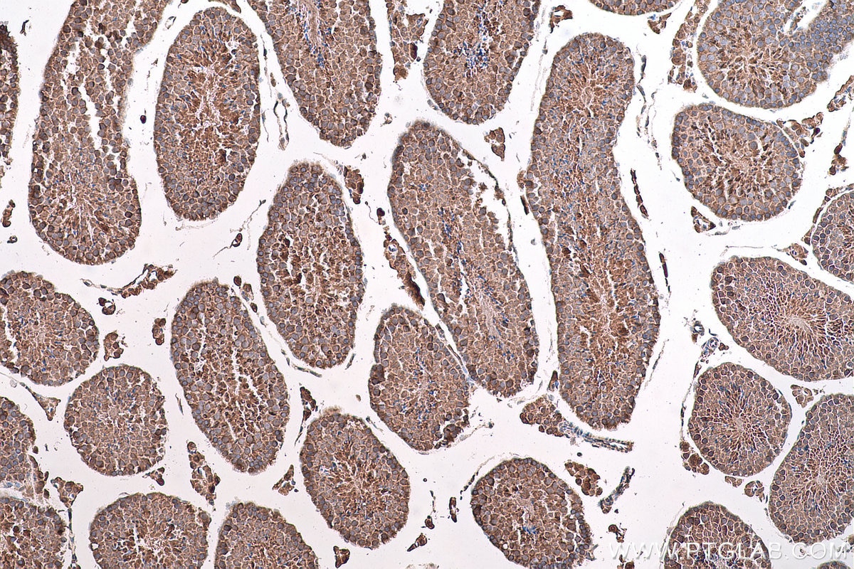 Immunohistochemical analysis of paraffin-embedded mouse testis tissue slide using KHC0809 (SLC16A12 IHC Kit).