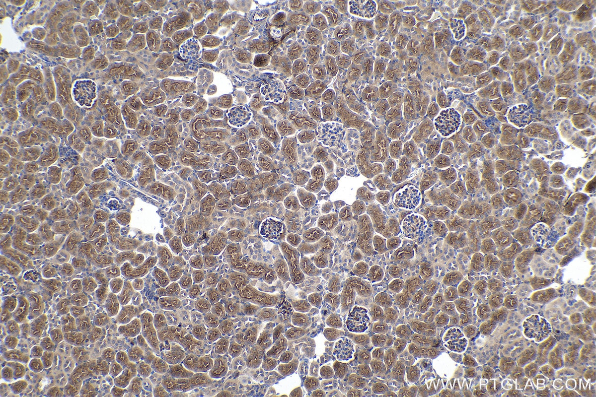 Immunohistochemical analysis of paraffin-embedded mouse kidney tissue slide using KHC0197 (SLC22A7 IHC Kit).