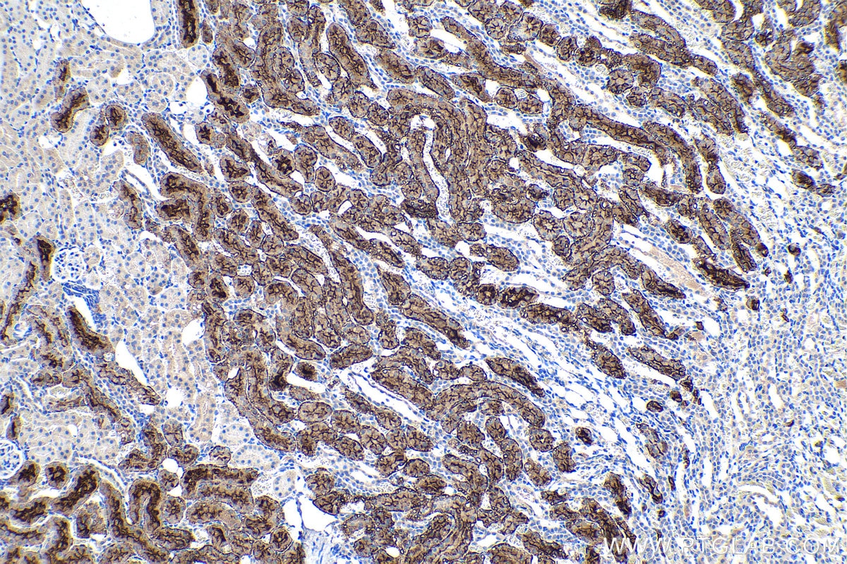 Immunohistochemical analysis of paraffin-embedded rat kidney tissue slide using KHC0197 (SLC22A7 IHC Kit).