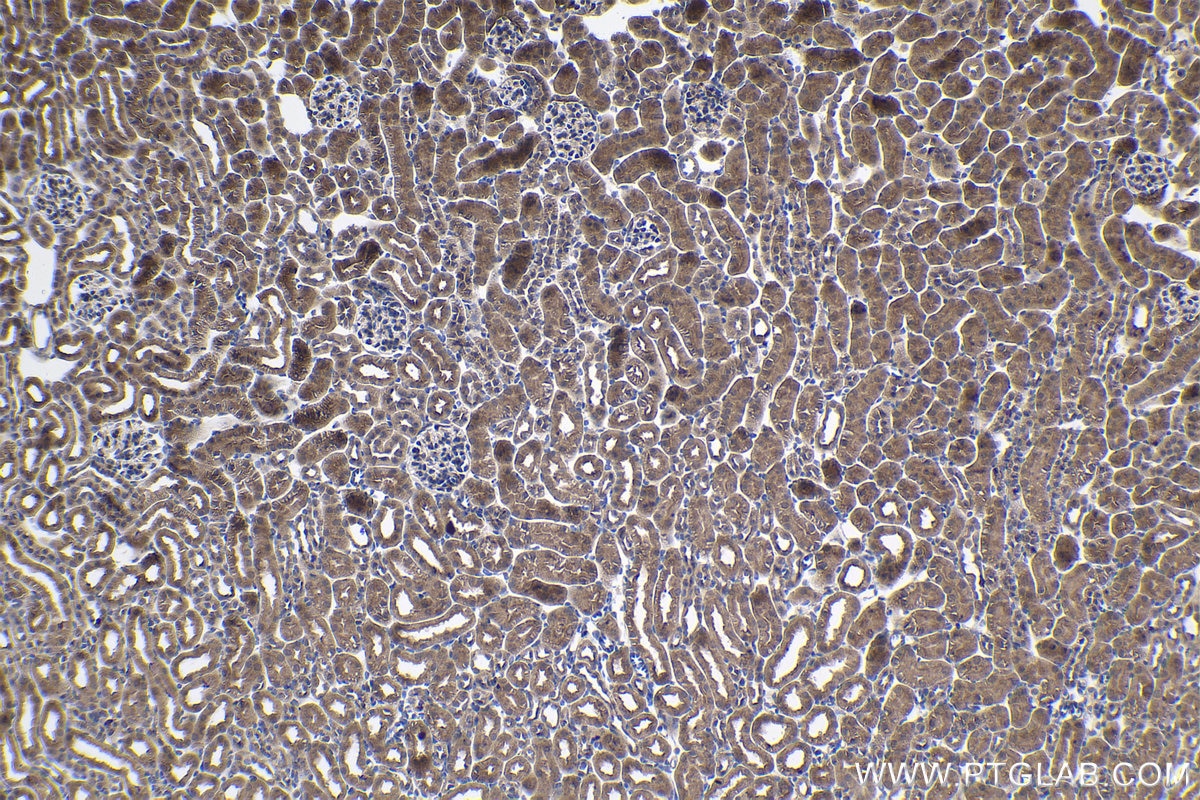Immunohistochemical analysis of paraffin-embedded mouse kidney tissue slide using KHC1087 (SLC25A42 IHC Kit).