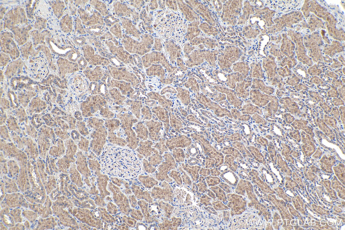 Immunohistochemical analysis of paraffin-embedded human kidney tissue slide using KHC1087 (SLC25A42 IHC Kit).