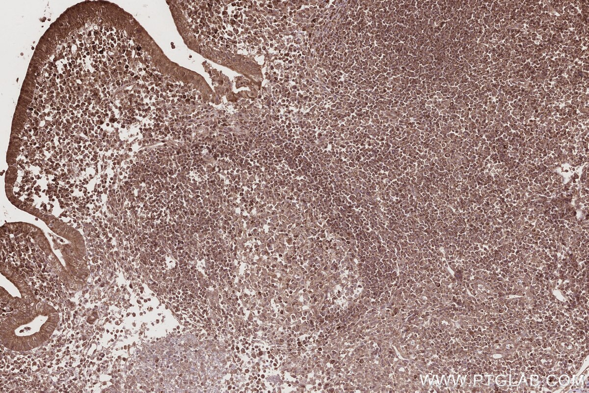 Immunohistochemical analysis of paraffin-embedded human appendicitis tissue slide using KHC2776 (SLC25A46 IHC Kit).
