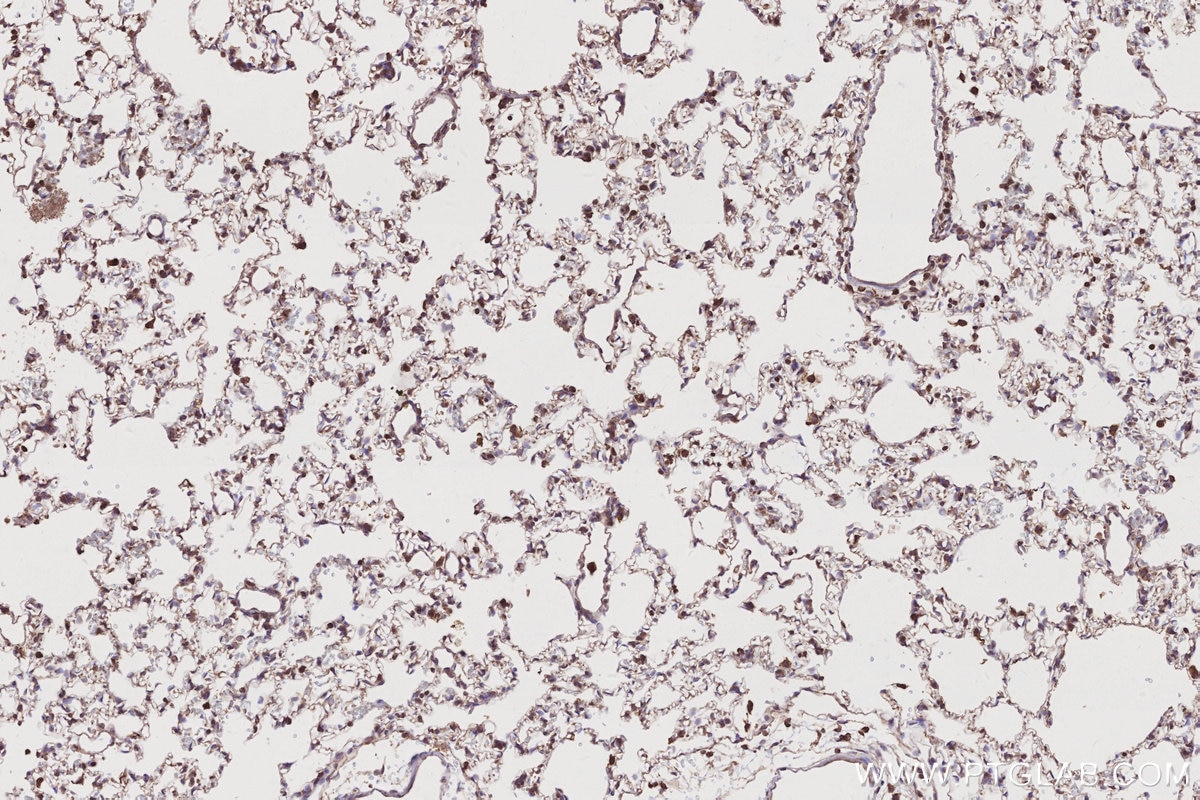 Immunohistochemical analysis of paraffin-embedded rat lung tissue slide using KHC2776 (SLC25A46 IHC Kit).