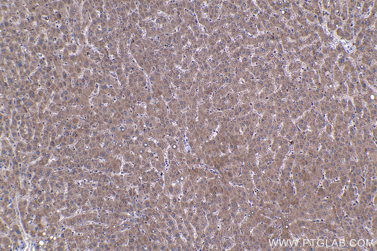 Immunohistochemical analysis of paraffin-embedded human liver tissue slide using KHC1148 (SLC25A5 IHC Kit).