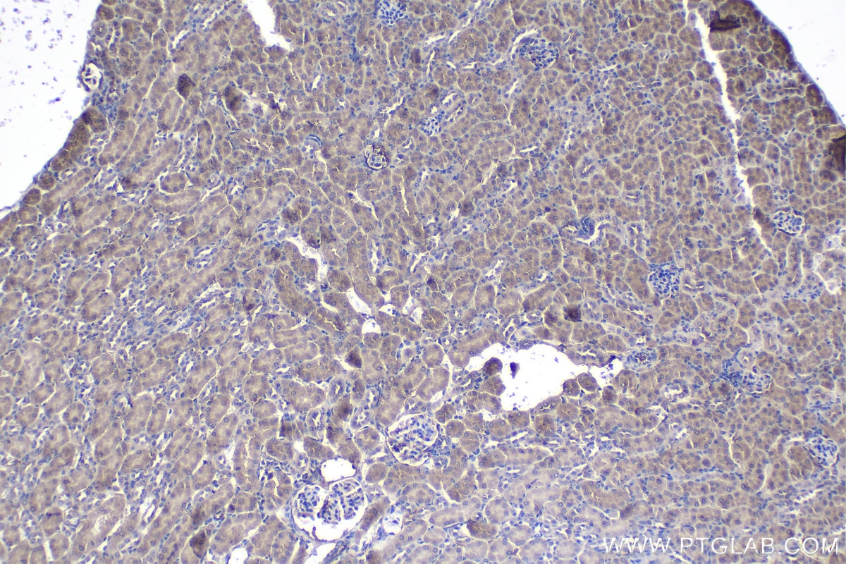 Immunohistochemical analysis of paraffin-embedded mouse kidney tissue slide using KHC1148 (SLC25A5 IHC Kit).